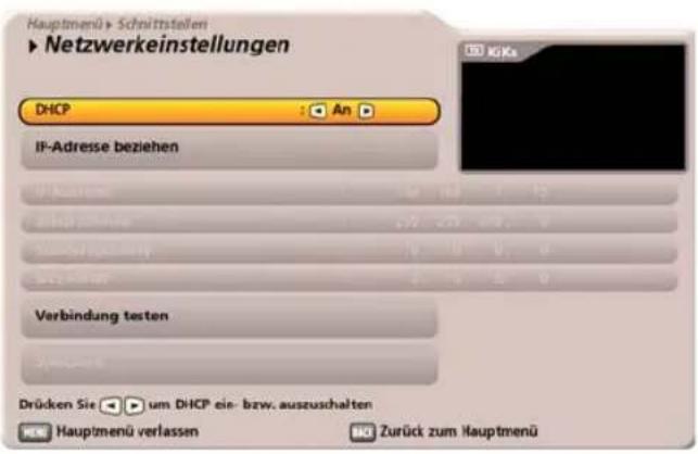 KATHREIN UFC 960 - DHCP „Aus“ (Hub/Switch/Direkte Verbindung zu PC oder Laptop) - 1