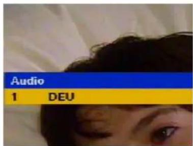 Audio 1 DEU