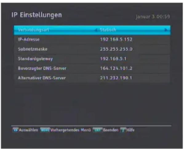TOPFIELD SRP 2100 TMS - Die Netzwerkkonfiguration des Digitalreceivers durchführen - 1