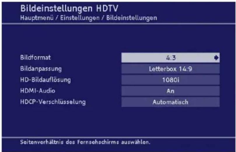 TechnoTrend TT-micro S830 HDTV - • Bildeinstellungen HDTV/SDTV - 1