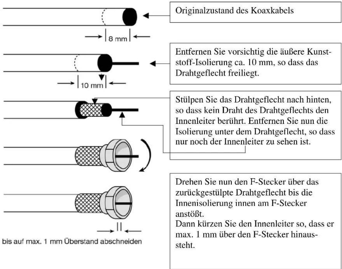 Boca SR 5003 - Der Lieferumfang der Anlage ist auf der Umkartonage angegeben !!!!! - 2