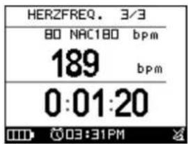 HER2FREQ. 3/3 80 NAC180 bpm 189 bpm 0:01:20 03:31PM