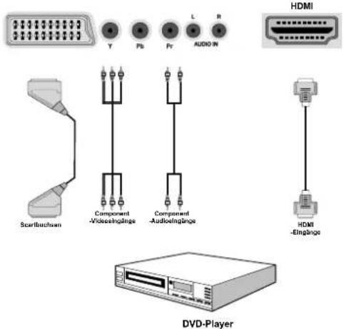 SCHAUB LORENZ 32LT511 - Anschluss eines DVD-Players - 1