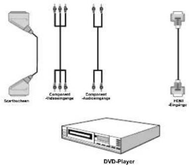 SCHAUB LORENZ 22LE-5101 - Anschluss eines DVD-Players - 1