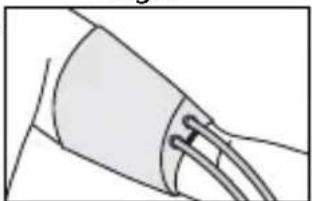 Little Doctor LD-80 - CUFF PREPARATION - 6