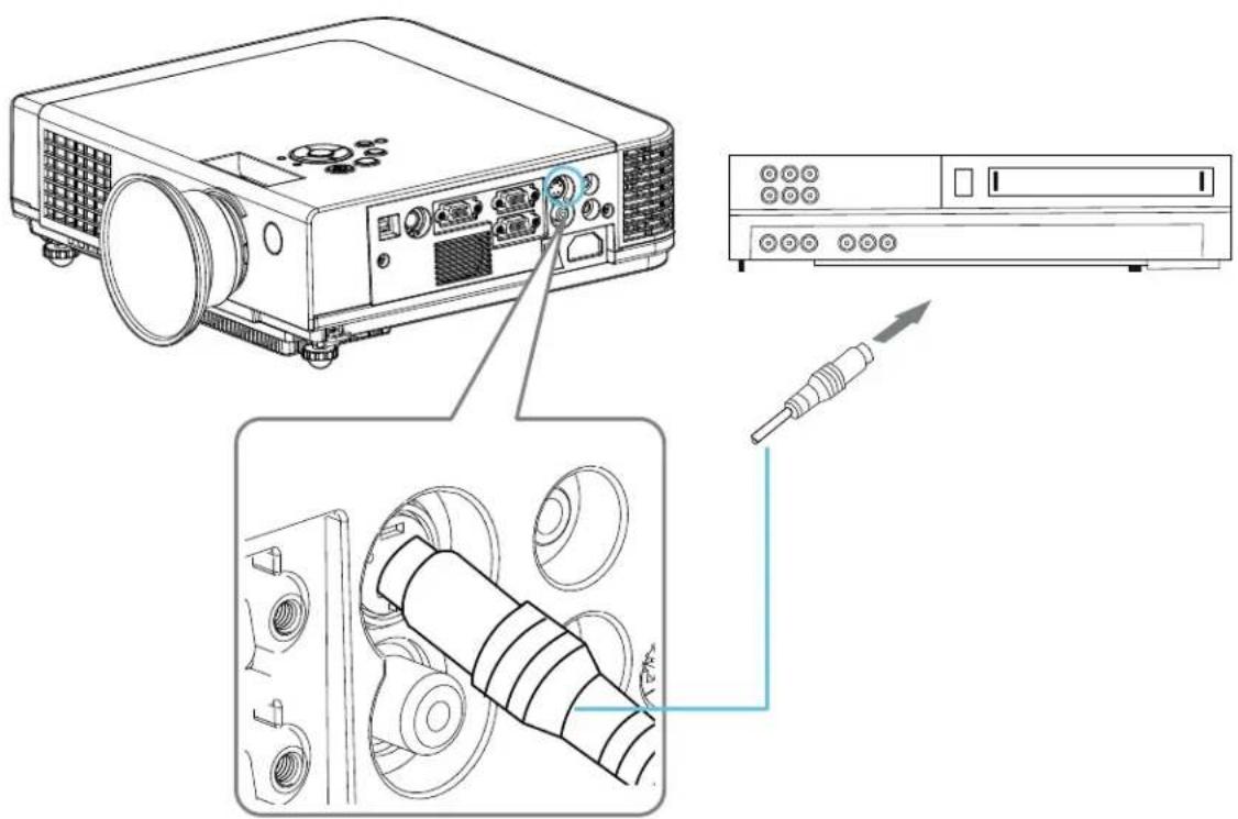 Kindermann KX 2950 - Video - 2