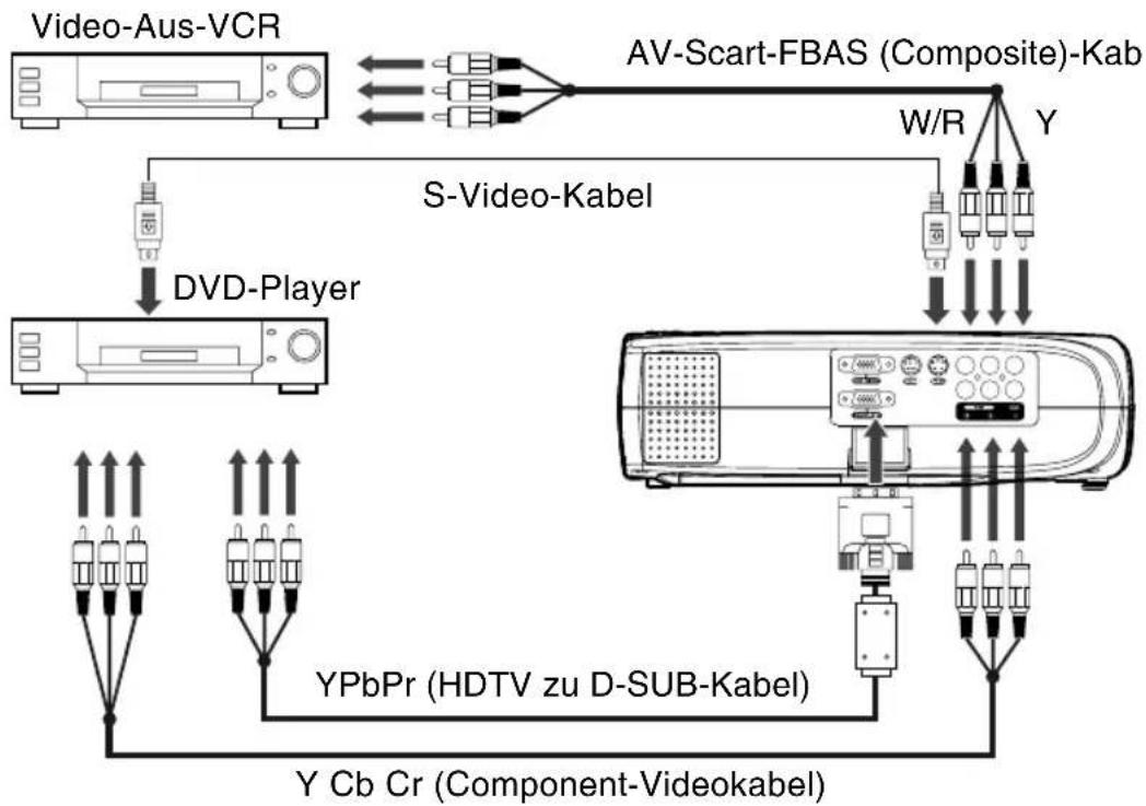 Kindermann KX 150 - Anschließen einer Videoquelle (S-Video, Component, Composite) - 1
