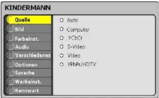 Kindermann KX 150 - Kein Eingabesignal - 1