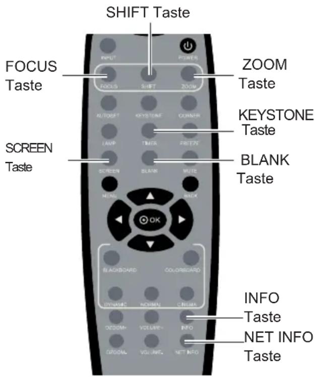 Kindermann KX 6000W - NET INFO Taste - 2
