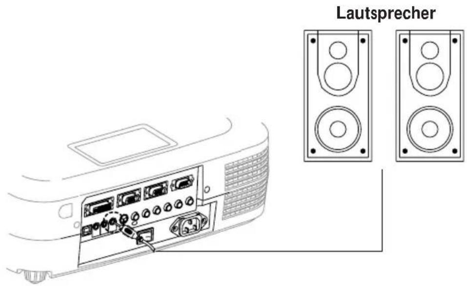 Kindermann KX 4000 - Externer Lautsprecher - 1