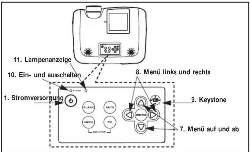 Kindermann KX 4000 - Steuerung über das Tastenfeld - 1