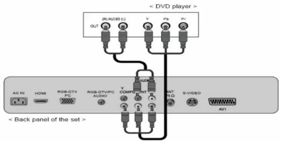 SCHAUB LORENZ LTW20-83H2-6 - DVD-Player: - 1