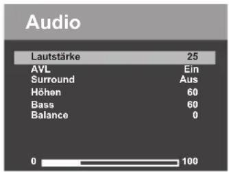 SCHAUB LORENZ LT20-82H1-6 - Toneinstellungen - 1
