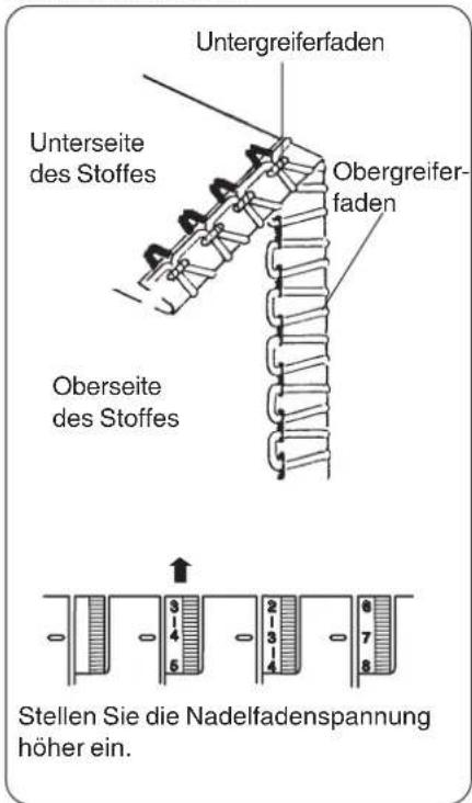 W6 N 454D - Einstellung der Fadenspannung; Nadelfaden ist lose - 1