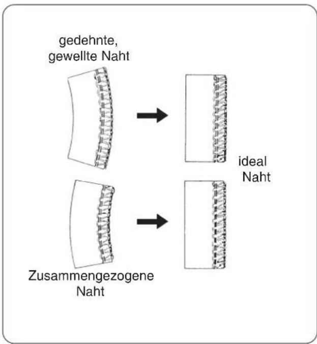 W6 N 454D - Anwendung des Differentialtransportes (nur Modell 454D) - 1