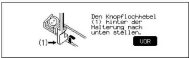 (1) Den Knopflochhebel (1) hinter der Halterung nach unten stellen. VOR