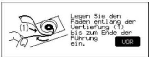 (1) Legen Sie den Faden entlang der Vertiefung (1) bis zum Ende der Führung ein. UOR