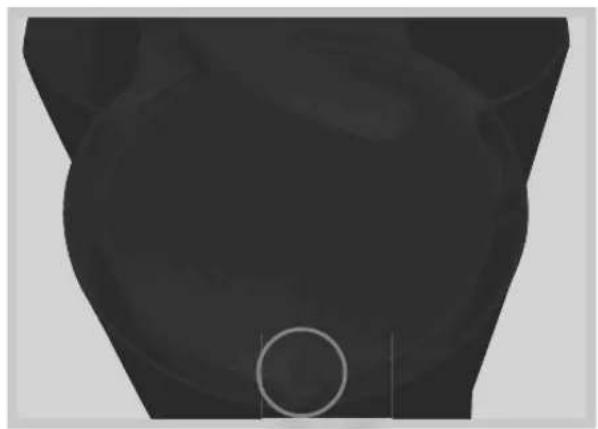KORONA 10113 - Inserting the filter holder - 1