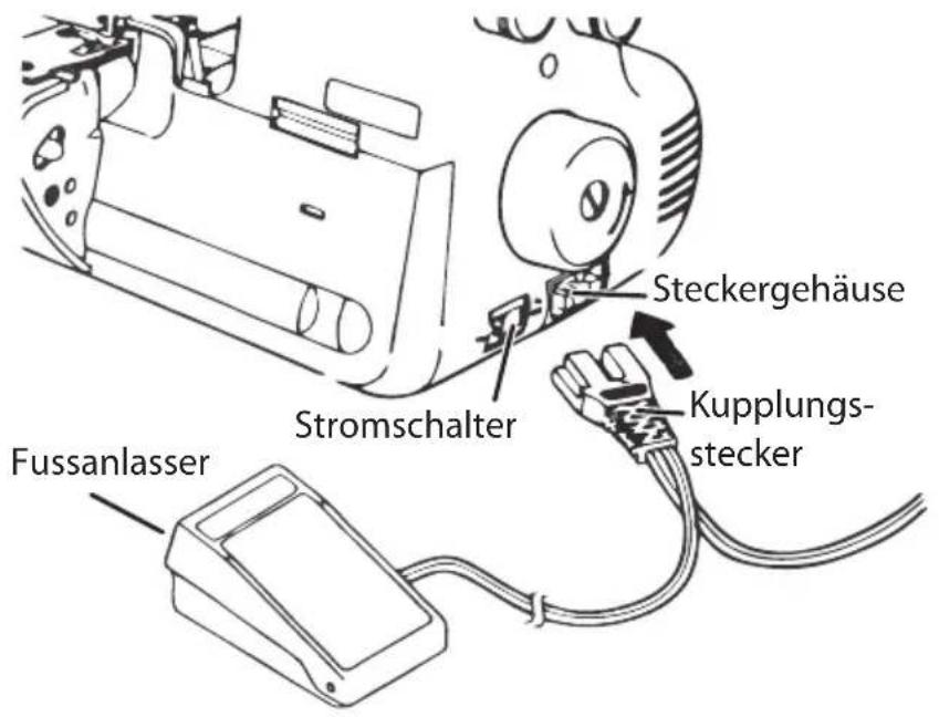 Home Electric MD 14302 - Fußanlasser anschließen - 1