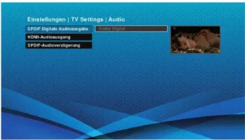 Schwaiger DTR700HD - S/PDIF Digitaler Audioausgabe - 1