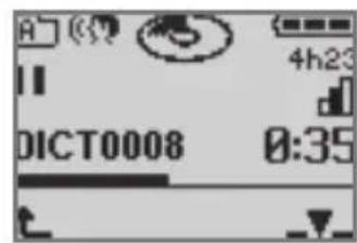 GRUNDIG Digta 422 - Inserting an index - 1