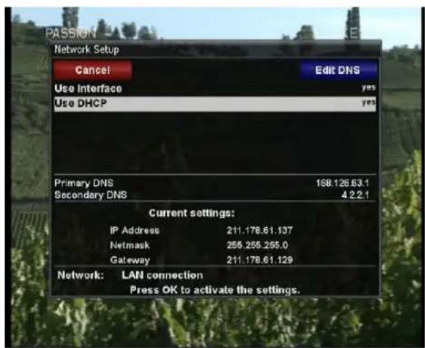 Xtrend ET9500 - • DHCP - 1