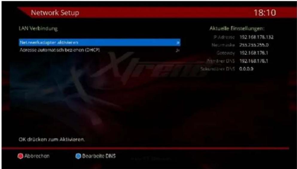 Xtrend ET8500 - - DHCP - 1