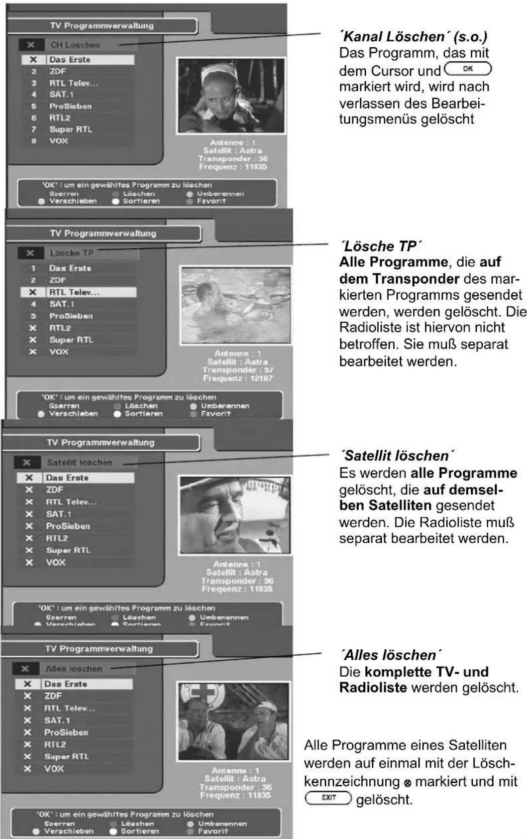 ZEHNDER ZX 1100 - Verschiedene Arten von Programmlöschfunktionen - 1