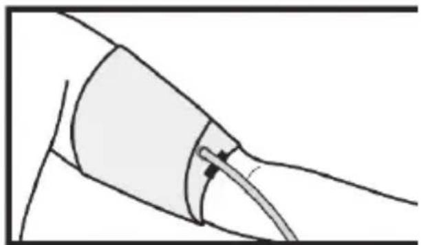 Medifit MD 509 - ASSEMBLIG THE CUFF - 6