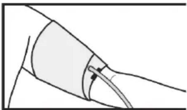Medifit MD 509 - ASAMBLAREA MANSETEI - 4