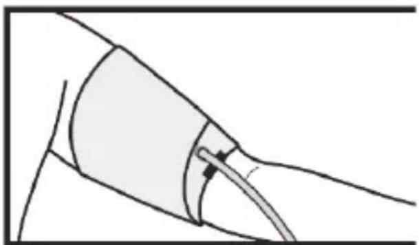 Medifit MD 509 - PREPARAZIONE DEL BRACCIALE - 3