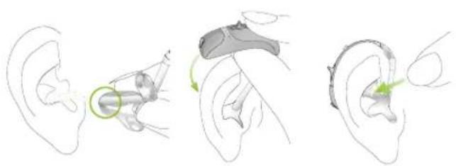 Phonak Sky Q - Using the hearing aid - 3
