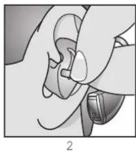 Audibel A3 BTE - To remove the hearing instrument and Custom Earmold: - 2