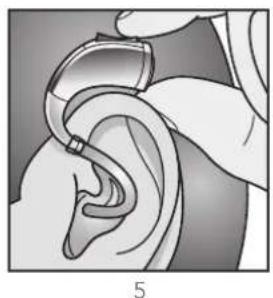 Audibel A3 BTE - To remove the hearing instrument and Custom Earmold: - 5