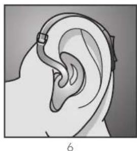 Audibel A2 BTE - To remove the hearing instrument and Custom Earmold: - 6