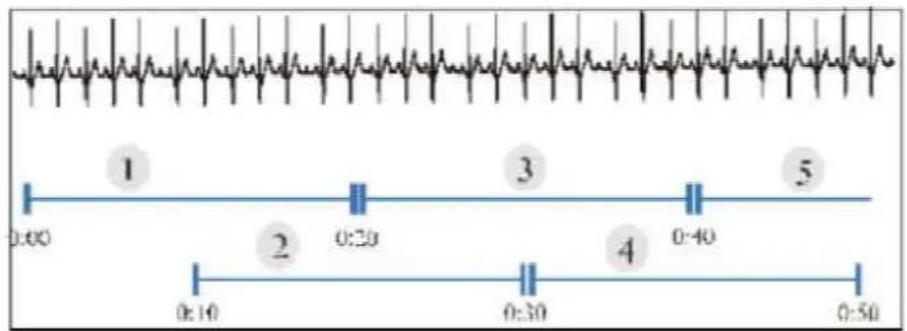1 0:00 2 0:20 3 0:40 4 0:30 5 0:50