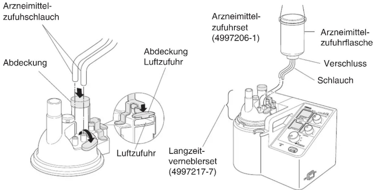 Arzneimittel- zufuhschlauch Abdeckung Abdeckung Luftzufuhr Luftzufuhr Langzeit- verneblerset (4997217-7) Arzneimittel- zufuhrset (4997206-1) Arzneimittel- zufuhrflasche Verschluss Schlauch