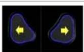 Etac Balder Move Basic - WARNUNG - 5