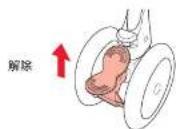 Aprica Soraria Auto - 〈解除〉 - 1