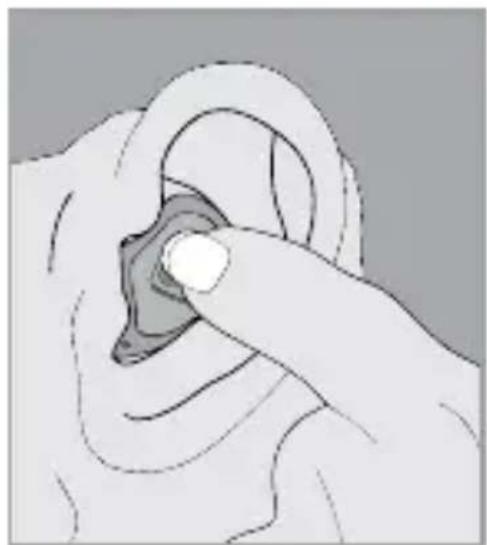 Starkey Z Series ITC - To insert the hearing instrument: - 2