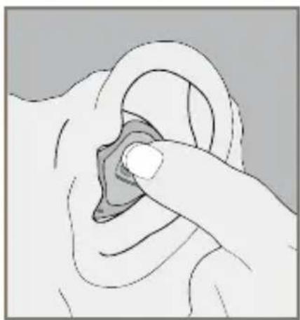 Starkey Wi Series CIC - Insertion and Removal - 2