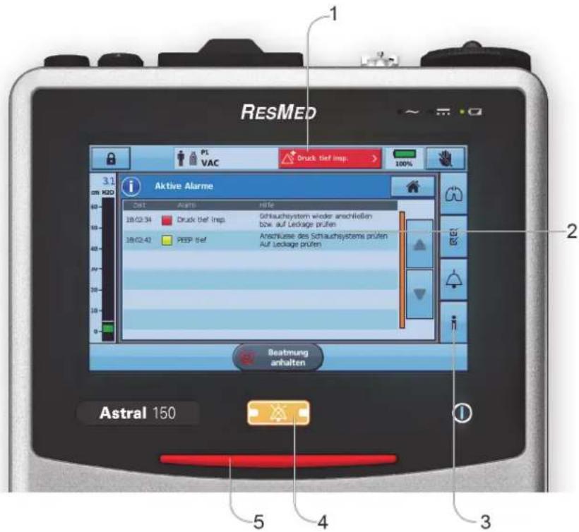 RESMED P1 VAC Druck tief imp. 100% 3.1 Aktive Alarme Set Alarm Hife 18/02:34 Druck tief imp. Schlauchsystem wieder anschließen bzw. auf Leckage prüfen 18/02:40 PEEP tief Anschluss des Schlauchsystems prüfen Auf Leckage prüfen Beatmung anhalten Astral 150 5 4 3