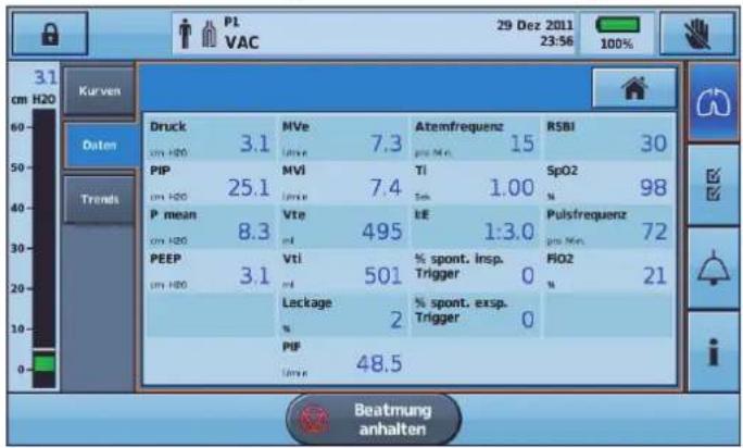 ResMed Astral 100 - Bildschirm „Daten“ - 1