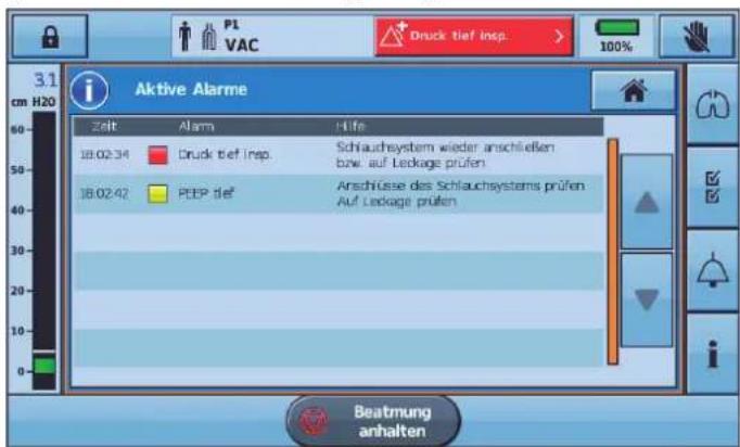 P1 VAC Druck tief insp. 3.1 cm H20 Aktive Alarme Zeit Alarm Hife 18:02:34 Druck tief Insp.Schlauchsystem wieder anschließen bzw. auf Leakage prüfen 18:02:42 PEEP tief Anschlüsse des Schlauchsystems prüfen Auf Leakage prüfen Beatmung anhalten