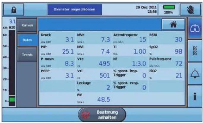 ResMed Astral 100 - Anschließen eines Pulsoximeters: - 2
