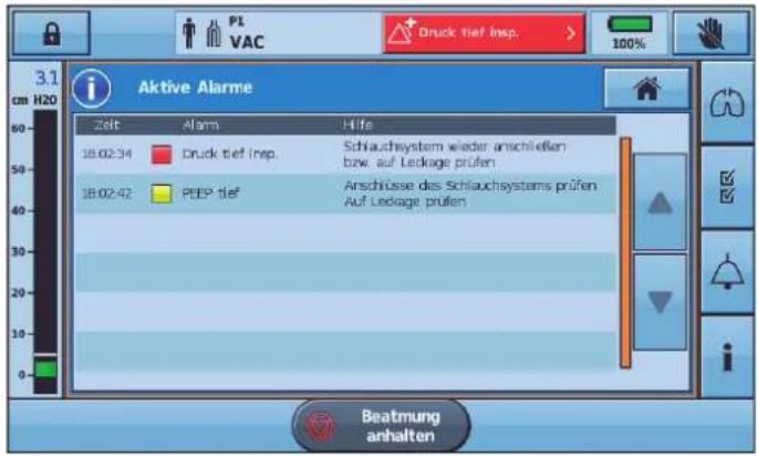 Aktive Alarme Zeit Alarm Hife 18.02.34 Druck tief Insp.Schlauchsystem wieder anschließen bzw. auf Ledlage prüfen 18.02.42 PEEP tief Anschlüsse des Schlauchsystems prüfen Auf Ledlage prüfen Beatmung anhalten