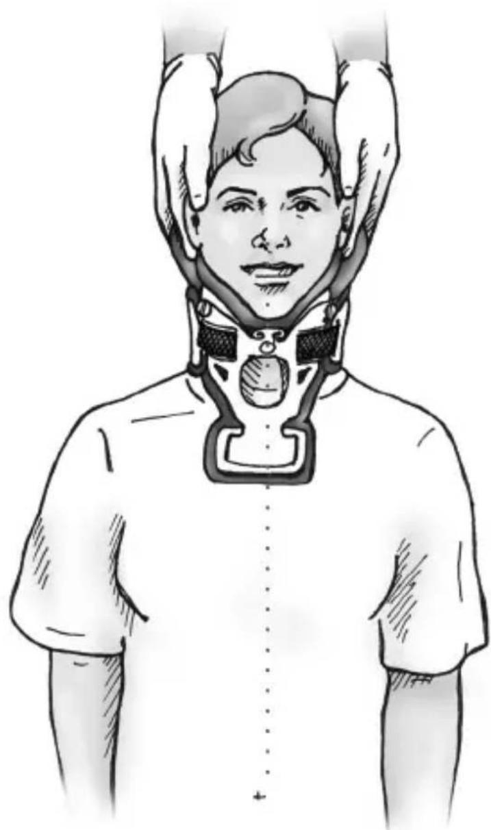 Ossur Miami J - C-SPINE PRECAUTIONS: - 1