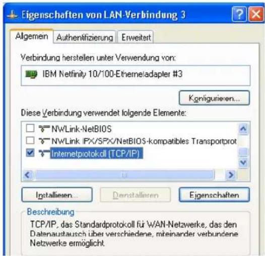 AVM KEN! 4 German - Windows XP und 2000 - 1