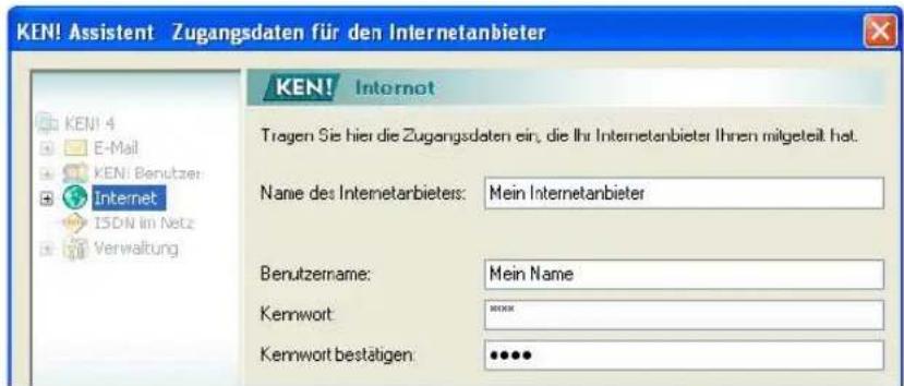 AVM KEN! 4 German - Schritt 5: KEN! Service mit dem Assistenten einrichten - 3