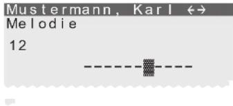 Bintec-elmeg CS410 - Sondertonruf (VIP-Tonruf) für Telefonbucheintrag einrichten - 3